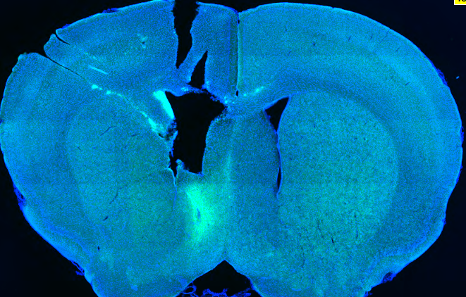 Addgene AAV Data Hub PAAV hSynapsin SF iGluSnFR A184S In Mouse AAV1 